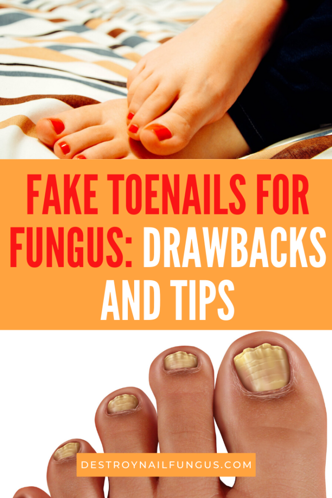 Should You Get Fake Toenails For Fungus? Know The Real Score